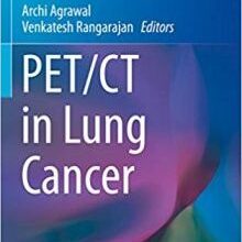 free-pdf-download-PET/CT in Lung Cancer (Clinicians’ Guides to Radionuclide Hybrid Imaging)