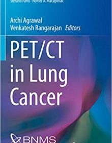 free-pdf-download-PET/CT in Lung Cancer (Clinicians’ Guides to Radionuclide Hybrid Imaging)