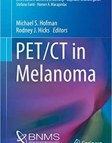 free-pdf-download-PET/CT in Melanoma (Clinicians’ Guides to Radionuclide Hybrid Imaging)