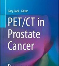 free-pdf-download-PET/CT in Prostate Cancer (Clinicians’ Guides to Radionuclide Hybrid Imaging) 1st ed. 2017 Edition