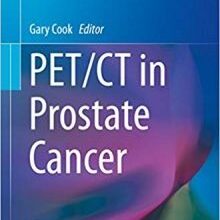 free-pdf-download-PET/CT in Prostate Cancer (Clinicians’ Guides to Radionuclide Hybrid Imaging)