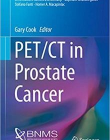 free-pdf-download-PET/CT in Prostate Cancer (Clinicians’ Guides to Radionuclide Hybrid Imaging)