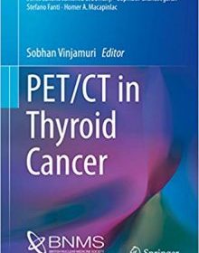 free-pdf-download-PET/CT in Thyroid Cancer (Clinicians’ Guides to Radionuclide Hybrid Imaging)