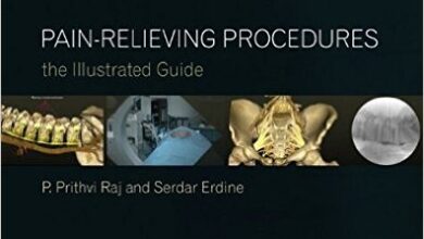 free-pdf-download-Pain-Relieving Procedures: The Illustrated Guide 1st Edition