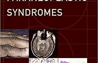 free-pdf-download-Paraneoplastic Syndromes (Contemporary Neurology Series) 1st Edition