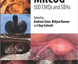 free-pdf-download-Part 2 MRCOG: 500 EMQs and SBAs