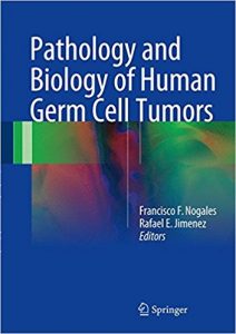 free-pdf-download-Pathology and Biology of Human Germ Cell Tumors 1st ed