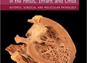 free-pdf-download-Pathology of Heart Disease in the Fetus