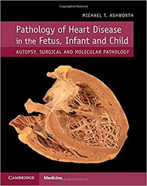 free-pdf-download-Pathology of Heart Disease in the Fetus