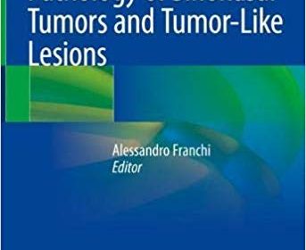 free-pdf-download-Pathology of Sinonasal Tumors and Tumor-Like Lesions