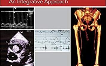 free-pdf-download-Patient Studies in Valvular