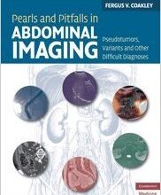 free-pdf-download-Pearls and Pitfalls in Abdominal Imaging: Pseudotumors