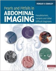 free-pdf-download-Pearls and Pitfalls in Abdominal Imaging: Pseudotumors