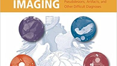 free-pdf-download-Pearls and Pitfalls in Cardiovascular Imaging: Pseudolesions