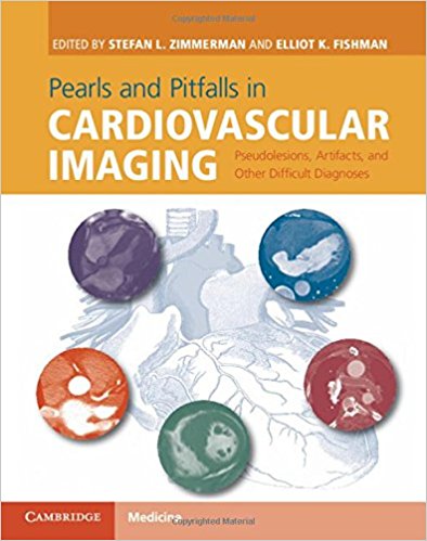 free-pdf-download-Pearls and Pitfalls in Cardiovascular Imaging: Pseudolesions