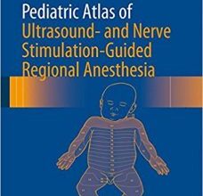 free-pdf-download-Pediatric Atlas of Ultrasound- and Nerve Stimulation-Guided Regional Anesthesia 1st ed. 2016 Edition