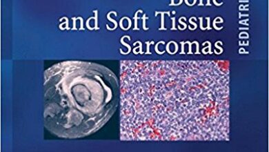 free-pdf-download-Pediatric Bone and Soft Tissue Sarcomas (Pediatric Oncology)