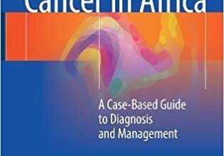 free-pdf-download-Pediatric Cancer in Africa: A Case-Based Guide to Diagnosis and Management 1st ed. 2017 Edition