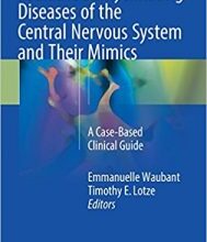 free-pdf-download-Pediatric Demyelinating Diseases of the Central Nervous System and Their Mimics: A Case-Based Clinical Guide 1st ed. 2017 Edition