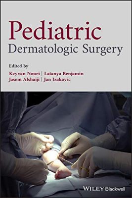 free-pdf-download-Pediatric Dermatologic Surgery