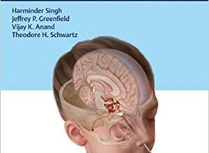 free-pdf-download-Pediatric Endoscopic Endonasal Skull Base Surgery