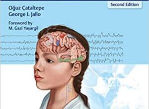 free-pdf-download-Pediatric Epilepsy Surgery: Preoperative Assessment and Surgical Treatment 2nd Edition