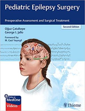 free-pdf-download-Pediatric Epilepsy Surgery: Preoperative Assessment and Surgical Treatment 2nd Edition