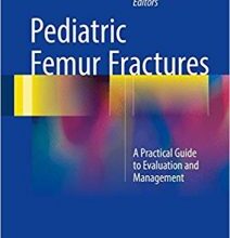 free-pdf-download-Pediatric Femur Fractures: A Practical Guide to Evaluation and Management 1st ed. 2016 Edition