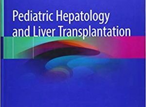 free-pdf-download-Pediatric Hepatology and Liver Transplantation