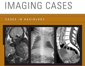 free-pdf-download-Pediatric Imaging Cases (Cases in Radiology)