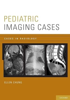 free-pdf-download-Pediatric Imaging Cases (Cases in Radiology)