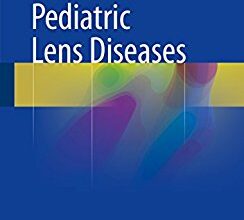 free-pdf-download-Pediatric Lens Diseases