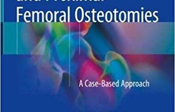 free-pdf-download-Pediatric Pelvic and Proximal Femoral Osteotomies: A Case-Based Approach 1st ed