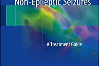 free-pdf-download-Pediatric Psychogenic Non-Epileptic Seizures: A Treatment Guide 1st ed. 2017 Edition