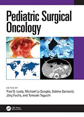 free-pdf-download-Pediatric Surgical Oncology