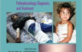 free-pdf-download-Pediatric Trauma: Pathophysiology