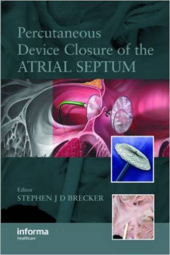 free-pdf-download-Percutaneous Device Closure of the Atrial Septum 1st Edition