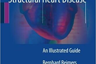 free-pdf-download-Percutaneous Interventions for Structural Heart Disease: An Illustrated Guide 1st ed. 2017 Edition