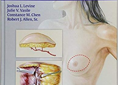 free-pdf-download-Perforator Flaps for Breast Reconstruction 1st Edition