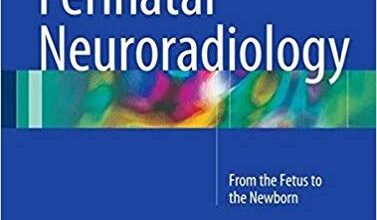 free-pdf-download-Perinatal Neuroradiology: From the Fetus to the Newborn