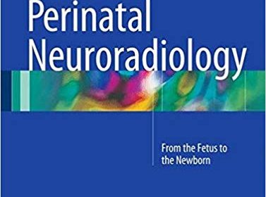 free-pdf-download-Perinatal Neuroradiology: From the Fetus to the Newborn