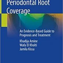 free-pdf-download-Periodontal Root Coverage: An Evidence-Based Guide to Prognosis and Treatment