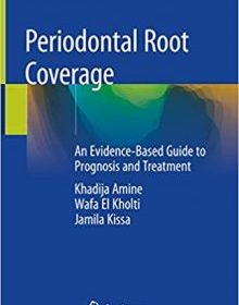 free-pdf-download-Periodontal Root Coverage: An Evidence-Based Guide to Prognosis and Treatment