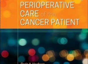 free-pdf-download-Perioperative Care of the Cancer Patient 1st Edition