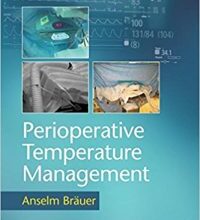 free-pdf-download-Perioperative Temperature Management 1st Edition