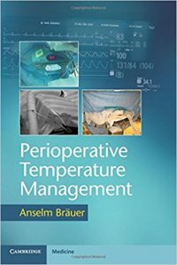 free-pdf-download-Perioperative Temperature Management 1st Edition