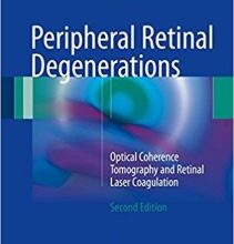 free-pdf-download-Peripheral Retinal Degenerations: Optical Coherence Tomography and Retinal Laser Coagulation 2nd ed. 2017 Edition