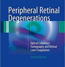 free-pdf-download-Peripheral Retinal Degenerations: Optical Coherence Tomography and Retinal Laser Coagulation 2nd ed. 2017 Edition