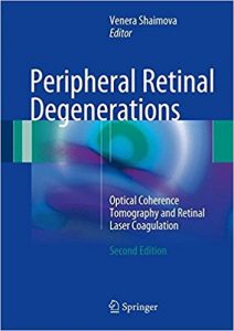 free-pdf-download-Peripheral Retinal Degenerations: Optical Coherence Tomography and Retinal Laser Coagulation 2nd ed. 2017 Edition