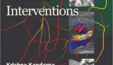 free-pdf-download-Peripheral Vascular Interventions 1st Edition